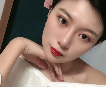 上海华美_许再荣医生_全切双眼皮+开眼角+上睑提肌_介绍分享!