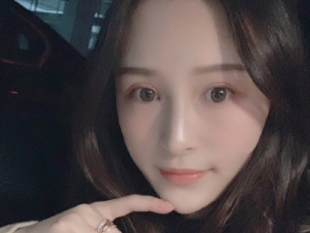 上海华美_许再荣医生_全切双眼皮+上睑提肌_介绍分享！