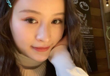 上海华美_许再荣医生_全切双眼皮+上睑提肌_介绍分享！