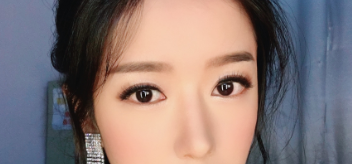 上海华美医疗美容医院佀同帅双眼皮介绍