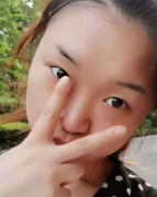 上海华美医疗美容医院佀同帅眼鼻部手术介绍
