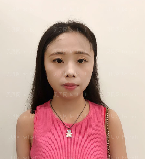 上海拜尔博尔口腔门诊逄秀凤隐形矫正介绍