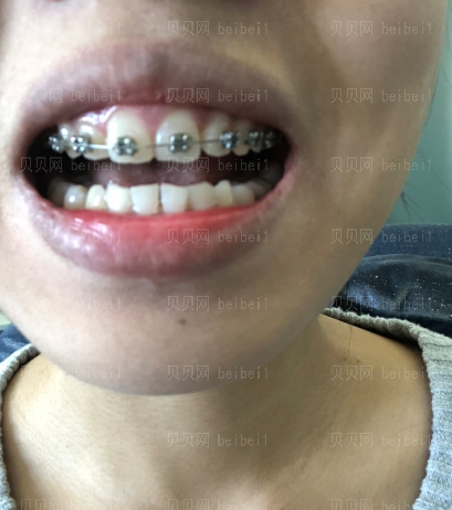 上海拜尔博尔口腔门诊逄秀凤牙齿矫正介绍