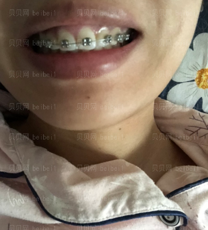 上海拜尔博尔口腔门诊逄秀凤牙齿矫正介绍