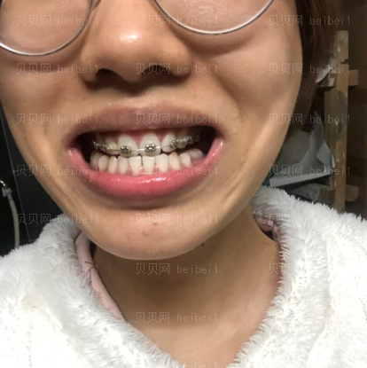 上海拜尔博尔口腔门诊逄秀凤牙齿矫正介绍