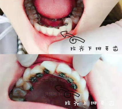 上海拜尔博尔口腔门诊逄秀凤舌侧矫正介绍