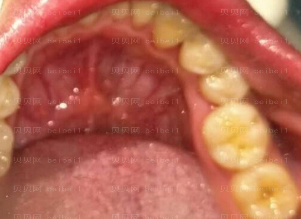 上海拜尔博尔口腔门诊孙健补牙介绍