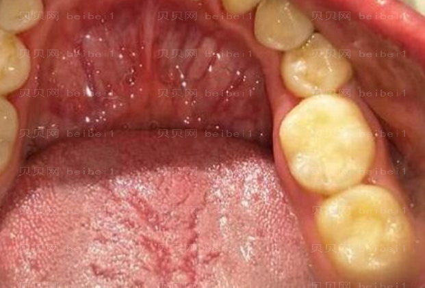 上海拜尔博尔口腔门诊孙健补牙介绍