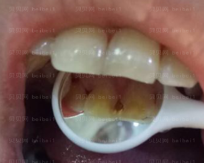 上海拜尔博尔口腔门诊孙健牙齿修复介绍