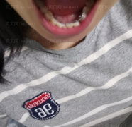 上海拜尔博尔口腔门诊孙健牙齿矫正介绍