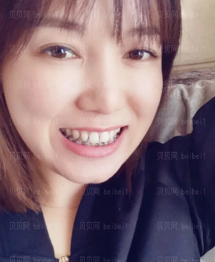上海拜尔博尔口腔门诊孙健牙齿矫正介绍