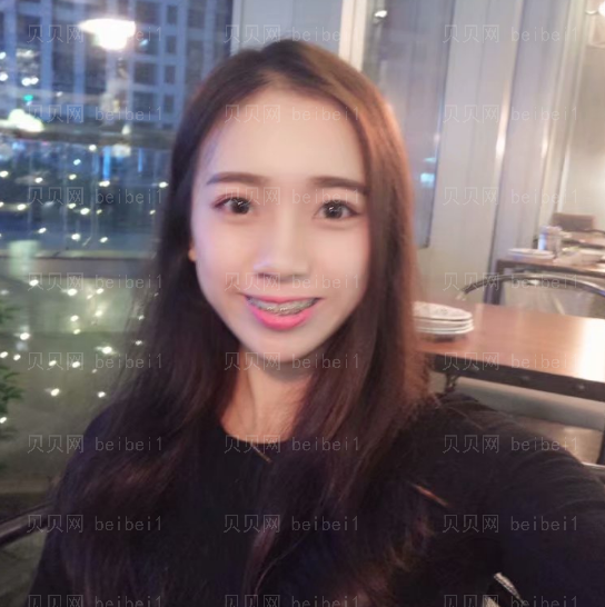 上海拜尔博尔口腔门诊杨国平金属托槽矫正介绍
