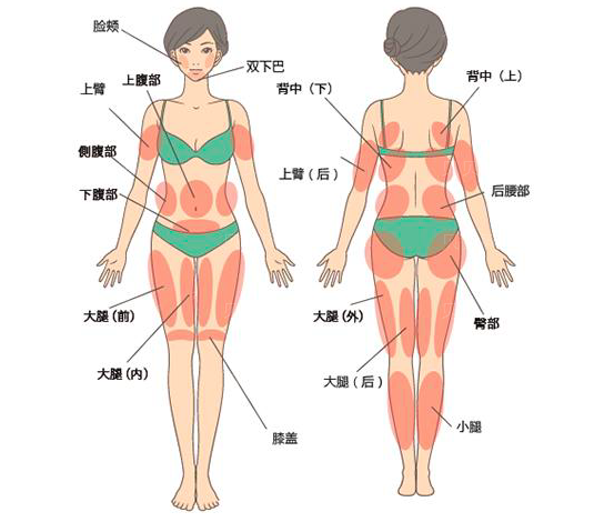 北京玉之光吸脂哪家好 大腿吸脂价钱是多少