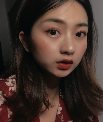 上海华美_程梓宁医生_埋线提升_介绍分享！
