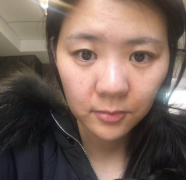 上海华美医疗美容医院顾锐龙埋线提升介绍