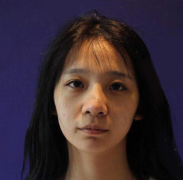 上海华美医疗美容医院顾锐龙——热玛吉介绍