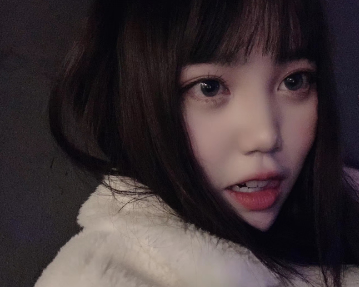 上海华美医疗美容医院顾锐龙——眼部手术+埋线提升介绍