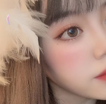 上海华美医疗美容医院顾锐龙——眼部手术+埋线提升介绍