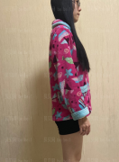 上海华美医疗美容医院何斌—大腿吸脂介绍