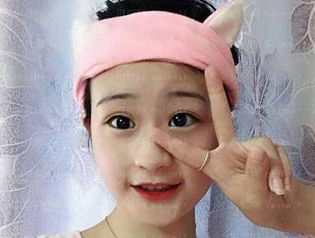 上海华美医疗美容医院黄兴勇植发介绍