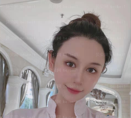 上海华美_黄兴勇医生_m型头发种植_介绍分享~