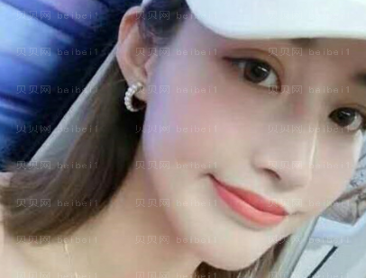 上海华美医疗美容医院杨定宇-埋线提升介绍