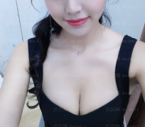 上海华美医疗美容医院张丽丽-自体脂肪隆胸介绍