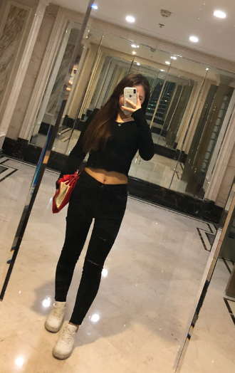 济南旭美美容医院娄亮亮腿部吸脂介绍