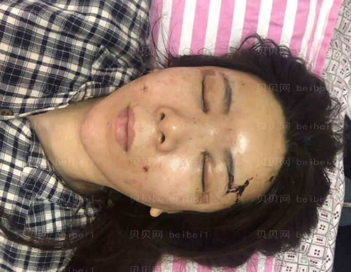 济南旭美美容医院娄亮亮眼部多项介绍