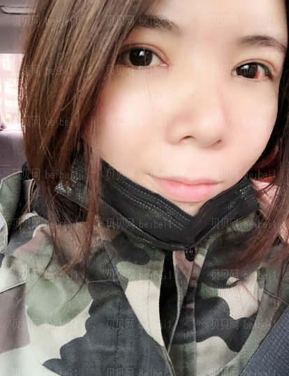 济南旭美美容医院娄亮亮眼部多项介绍