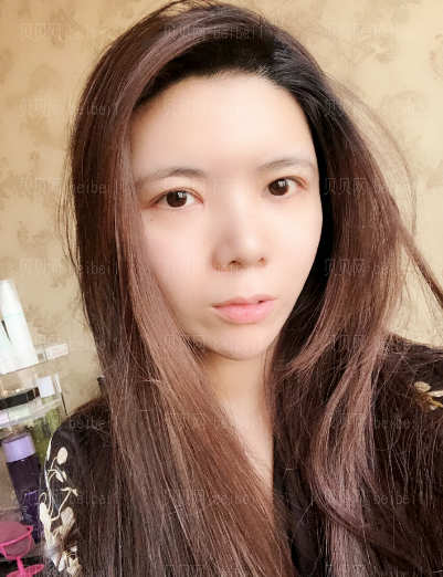 济南旭美美容医院娄亮亮眼部多项介绍