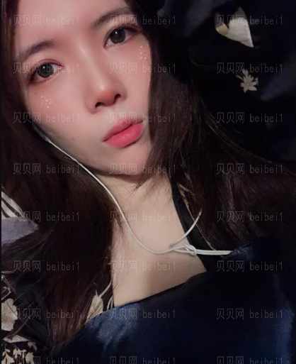 济南旭美美容医院娄亮亮眼部多项介绍