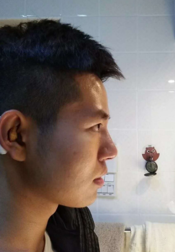 济南旭美美容医院娄亮亮鼻部多项介绍