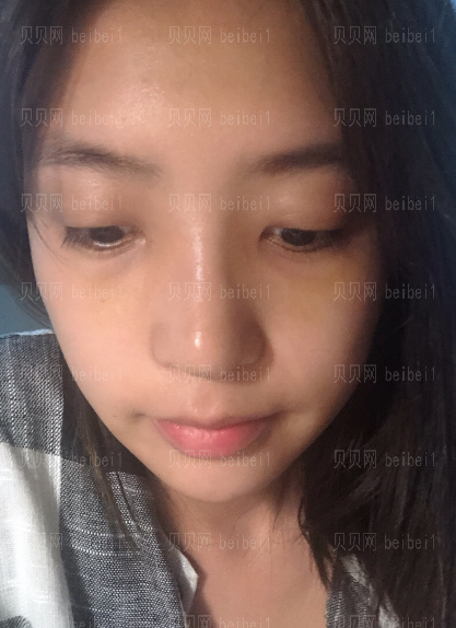 济南旭美美容医院王彪鼻部多项介绍