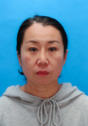 济南旭美美容医院赵子康面部年轻化介绍