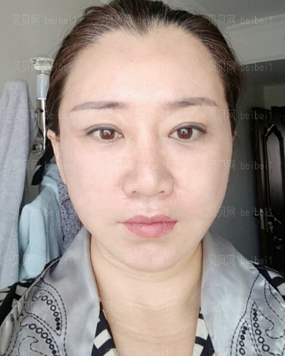 济南旭美美容医院赵子康面部年轻化介绍