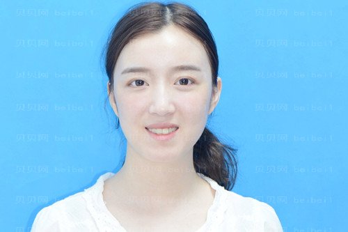 上海诗诺雅医疗美容医院赵丹阳地包天正畸介绍