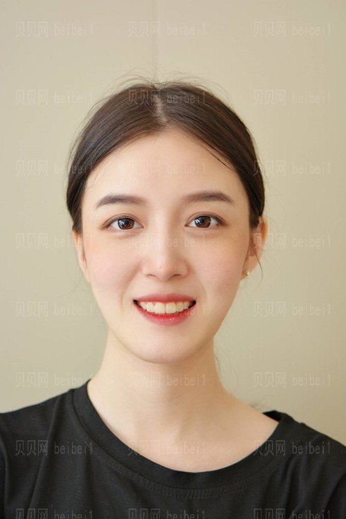 上海诗诺雅医疗美容医院赵丹阳地包天正畸介绍