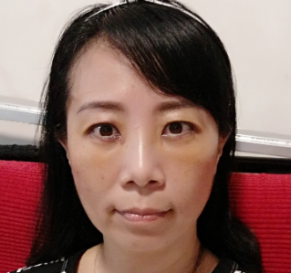 广州华美医疗美容整形医院袁耀东不开刀去眼袋介绍