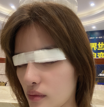 深圳博美医疗美容整形医院王红玮韩式切开眼皮介绍