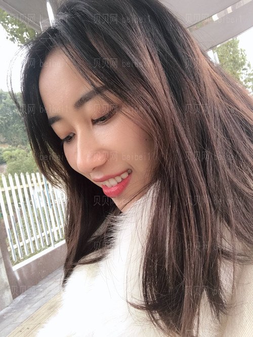 上海诗诺雅医疗美容医院赵丹阳牙齿矫正介绍