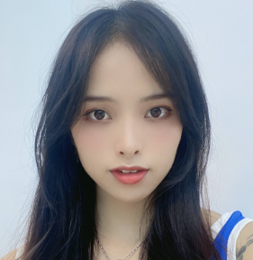 广州华美医疗美容整形医院郑志芳磨骨介绍