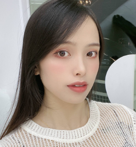 广州华美医疗美容整形医院郑志芳磨骨介绍