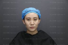 上海诗诺雅医疗美容医院许祐荣玻尿酸填充介绍 