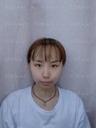 上海诗诺雅医疗美容医院许祐荣双眼皮介绍