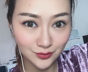 广州华美医疗美容整形医院张明兴假体丰下巴介绍