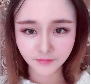 广州华美医疗美容整形医院张明兴除皱瘦脸介绍