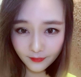 广州华美医疗美容整形医院张明兴除皱瘦脸介绍