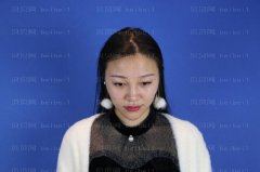 上海诗诺雅医疗美容医院方贻松鼻部手术介绍