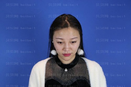 上海诗诺雅医疗美容医院方贻松鼻部手术介绍